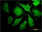 ALDOA Antibody (monoclonal) (M01)