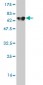 ALDOA Antibody (monoclonal) (M01)