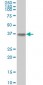 ALDOA Antibody (monoclonal) (M01)