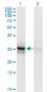 ALDOA Antibody (monoclonal) (M01)