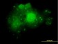 ALDOA Antibody (monoclonal) (M02)