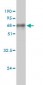 ALDOA Antibody (monoclonal) (M02)