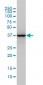 ALDOA Antibody (monoclonal) (M02)