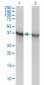 ALDOA Antibody (monoclonal) (M02)