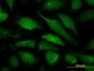 ALG6 Antibody (monoclonal) (M09)