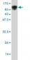 ALOX15 Antibody (monoclonal) (M04)