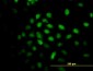 ALS2CR8 Antibody (monoclonal) (M01)