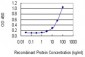 AMACR Antibody (monoclonal) (M02)