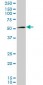 AMACR Antibody (monoclonal) (M02)