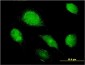 AMBP Antibody (monoclonal) (M01)