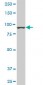 AMPD2 Antibody (monoclonal) (M01)