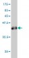 ANKRD15 Antibody (monoclonal) (M01)