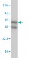 ANP32A Antibody (monoclonal) (M01)