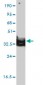 ANXA2 Antibody (monoclonal) (M01)