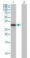 ANXA3 Antibody (monoclonal) (M12)