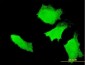 APC Antibody (monoclonal) (M01)