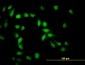 API5 Antibody (monoclonal) (M01)