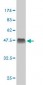 APLN Antibody (monoclonal) (M02)