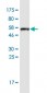 APOA1 Antibody (monoclonal) (M01)