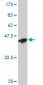 APOM Antibody (monoclonal) (M01)