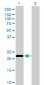 APOM Antibody (monoclonal) (M01)