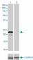 APOM Antibody (monoclonal) (M01)