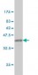 ARF5 Antibody (monoclonal) (M01)