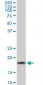 ARF5 Antibody (monoclonal) (M01)