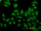 ARF5 Antibody (monoclonal) (M01)