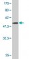 ARHGDIA Antibody (monoclonal) (M02)