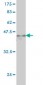 ARID1B Antibody (monoclonal) (M01)