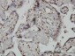 ARID1B Antibody (monoclonal) (M02)
