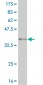 ARID1B Antibody (monoclonal) (M02)