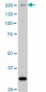 ARID1B Antibody (monoclonal) (M02)