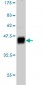 ARNT Antibody (monoclonal) (M01)