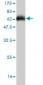 ARPC2 Antibody (monoclonal) (M01)