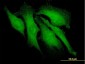 ARRB2 Antibody (monoclonal) (M01)