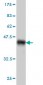 ARRB2 Antibody (monoclonal) (M01)