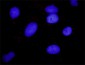 ARRB2 Antibody (monoclonal) (M01)