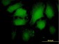 ARRB2 Antibody (monoclonal) (M06)