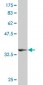 ARRB2 Antibody (monoclonal) (M06)