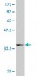 ARRB2 Antibody (monoclonal) (M06)