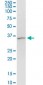 ARRB2 Antibody (monoclonal) (M06)