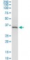 ARRB2 Antibody (monoclonal) (M06)