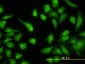ASL Antibody (monoclonal) (M01)