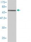 ASL Antibody (monoclonal) (M01)