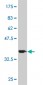 ATP13A2 Antibody (monoclonal) (M06)