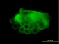 ATP2A1 Antibody (monoclonal) (M01)