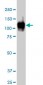 ATP2A1 Antibody (monoclonal) (M01)