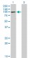 ATP2A1 Antibody (monoclonal) (M01)